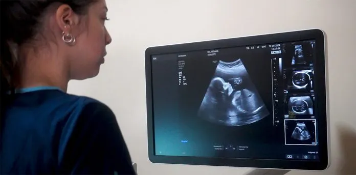 web-Ecografia-1-696x344